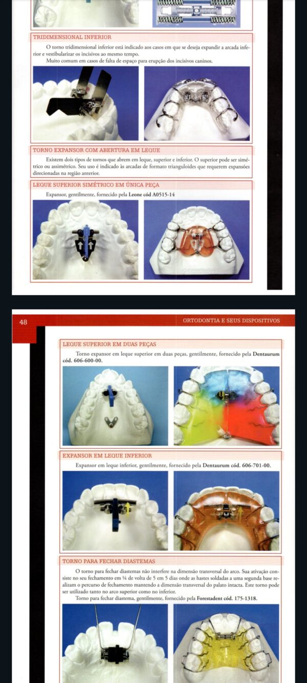 Curso Completo de Aparelhos Móveis Odontológicos