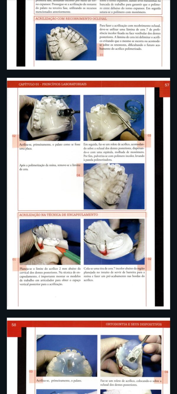 Curso Completo de Aparelhos Móveis Odontológicos - Image 3