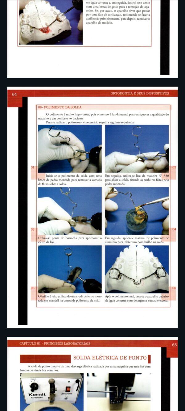 Curso Completo de Aparelhos Móveis Odontológicos - Image 4