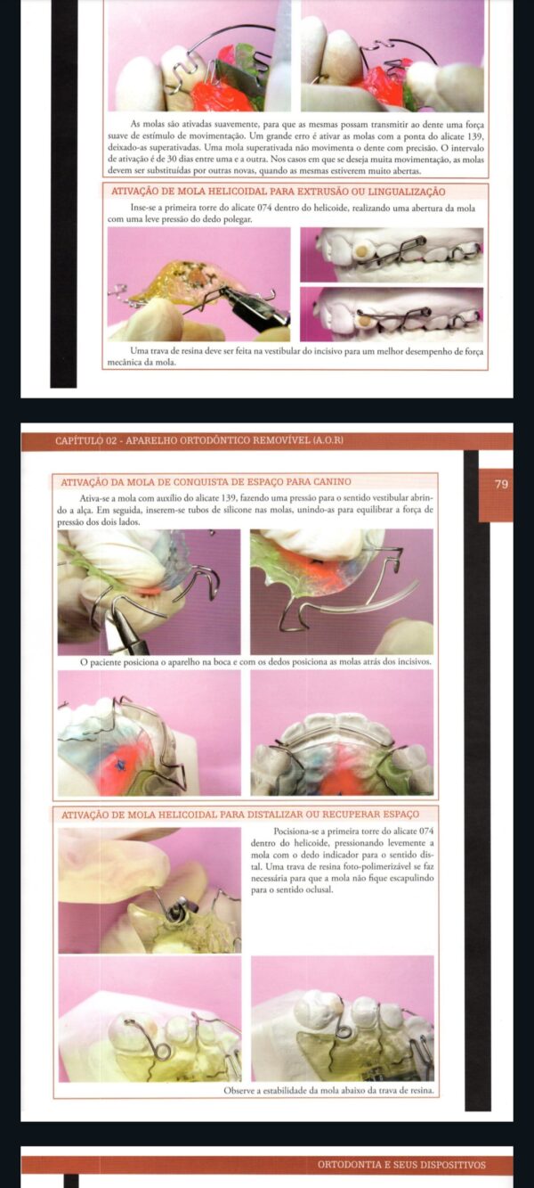 Curso Completo de Aparelhos Móveis Odontológicos - Image 5
